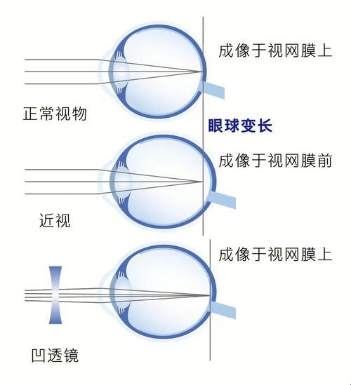 《谜谭“二蟆”传奇：诡谲文言文的另类解读》