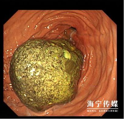 肠子上的巨无霸，科技界的崛起异类