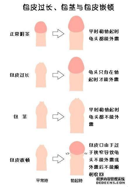 “潮男”新解：精子竞速与科技前沿的碰撞